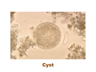 Cyst
 