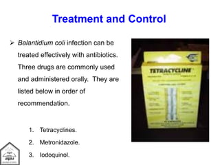 Treatment and Control
 Balantidium coli infection can be
treated effectively with antibiotics.
Three drugs are commonly used
and administered orally. They are
listed below in order of
recommendation.
1. Tetracyclines.
2. Metronidazole.
3. Iodoquinol.
 