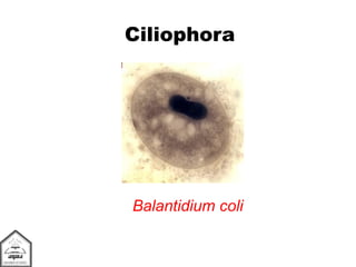 Ciliophora
Balantidium coli
 