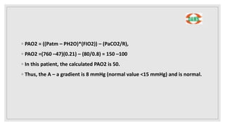 Medicine Respiratory Medicine DVT FOR NEETPG ASPIRANTS | PDF