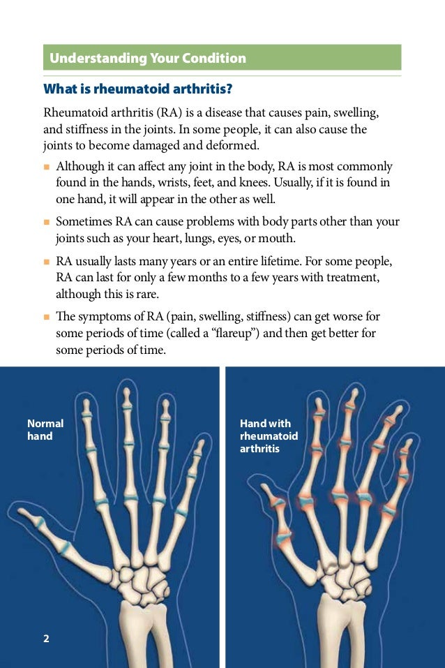 Global Medical Cures™ Medicines for Rheumatoid Arthritis