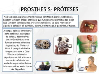 PROSTHESIS- PRÓTESES
Não são apenas para os membros que constroem próteses robóticas.
Existem também órgãos artificiais que funcionam automatizados e por
isso também considerados artefactos robóticos. Só para mencionar
alguns: o coração, os pulmões, os rins, o estômago, o pâncreas, o fígado.
A Darpa, agência americana
para pesquisas avançadas
de defesa, desenvolveu
uma mão robótica que
funciona como a de Luke
Skywalker, do filme Star
Wars.A pesquisa foi feita
em parceria com a Case
Western University.
A prótese robótica fornece
sensação suficiente em
cada dedo para devolver o
tato ao usuário, assim como
Luke Skywalker.
 