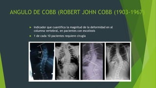 Medicion del angulo de cobb, para el diagnostico de ddc.pptx