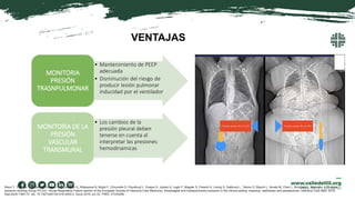 MÉTODO PACIENTES INTERVENCION CONCLUSIONES
Ensayo
multicéntrico
200 pacientes mayores de 16
años con ventilación mecánica
...