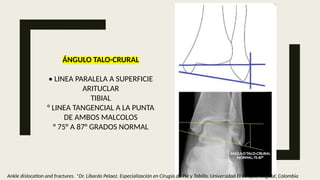 Tibia Linea mediciones radiograficas 2 jjnajssadjjajsd | PPTX