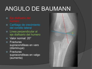 ANGULO DE BAUMANN 
 Eje diafisario del 
humero 
 Cartilago de crecimiento 
del condilo lateral 
 Linea perpendicular al 
eje diafisario del humero 
 Valor normal: 20° 
 Fracturas 
supracondileas en varo 
(disminuye) 
 Fracturas 
supracondileas en valgo 
(aumenta) 
 