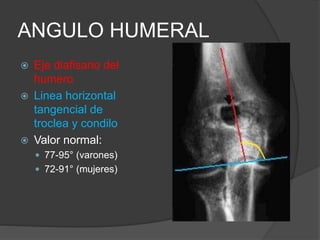 ANGULO HUMERAL 
 Eje diafisario del 
humero 
 Linea horizontal 
tangencial de 
troclea y condilo 
 Valor normal: 
 77-95° (varones) 
 72-91° (mujeres) 
 