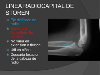 LINEA RADIOCAPITAL DE 
STOREN 
 Eje diafisario de 
radio 
 Centro del 
capitellum del 
humero 
 No varia en 
extension o flexion 
 Util en niños 
 Descarta luxacion 
de la cabeza de 
radio 
 