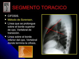 SSEEGGMMEENNTTOO TTOORRAACCIICCOO 
 CCIIFFOOSSIISS.. 
 MMééttooddoo ddee SSoorreennsseenn.. 
 LLíínneeaa qquuee ssee pprroolloonngguuee 
ssoobbrree eell bboorrddee ssuuppeerriioorr 
ddee ccppoo.. VVeerrtteebbrraall ddee 
ttrraannssiicciióónn.. 
 LLiinneeaa ssoobbrree eell bboorrddee 
iinnffeerriioorr ddeell ccppoo.. VVeerrtteebbrraall 
ddoonnddee tteerrmmiinnaa llaa cciiffoossiiss.. 
 