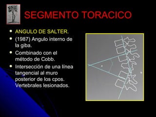 SSEEGGMMEENNTTOO TTOORRAACCIICCOO 
 AANNGGUULLOO DDEE SSAALLTTEERR.. 
 ((11998877)) AAnngguulloo iinntteerrnnoo ddee 
llaa ggiibbaa.. 
 CCoommbbiinnaaddoo ccoonn eell 
mmééttooddoo ddee CCoobbbb.. 
 IInntteerrsseecccciióónn ddee uunnaa llíínneeaa 
ttaannggeenncciiaall aall mmuurroo 
ppoosstteerriioorr ddee llooss ccppooss.. 
VVeerrtteebbrraalleess lleessiioonnaaddooss.. 
 