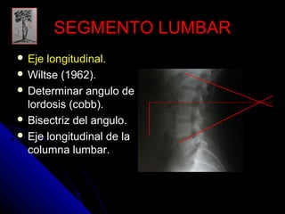 SSEEGGMMEENNTTOO LLUUMMBBAARR 
 EEjjee lloonnggiittuuddiinnaall.. 
WWiillttssee ((11996622)).. 
 DDeetteerrmmiinnaarr aanngguulloo ddee 
lloorrddoossiiss ((ccoobbbb)).. 
 BBiisseeccttrriizz ddeell aanngguulloo.. 
 EEjjee lloonnggiittuuddiinnaall ddee llaa 
ccoolluummnnaa lluummbbaarr.. 
 