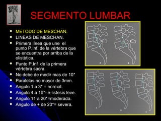 SSEEGGMMEENNTTOO LLUUMMBBAARR 
 MMEETTOODDOO DDEE MMEESSCCHAANN.. 
 LLIINNEEAASS DDEE MMEESSCCHAANN.. 
 PPrriimmeerraa llíínneeaa qquuee uunnee eell 
ppuunnttoo PP..IInnff.. ddee llaa vvéérrtteebbrraa qquuee 
ssee eennccuueennttrraa ppoorr aarrrriibbaa ddee llaa 
oolliissttèèttiiccaa.. 
 PPuunnttoo PP..IInnff ddee llaa pprriimmeerraa 
vvéérrtteebbrraa ssaaccrraa.. 
 NNoo ddeebbee ddee mmeeddiirr mmaass ddee 1100** 
 PPaarraalleellaass nnoo mmaayyoorr ddee 33mmmm.. 
 AAnngguulloo 11 aa 33** == nnoorrmmaall.. 
 AAnngguulloo 44 aa 1100**==ee--lliisstteessiiss lleevvee.. 
 AAnngguulloo 1111 aa 2200**==mmooddeerraaddaa.. 
 AAnngguulloo ddee ++ ddee 2200**== sseevveerraa.. 
 