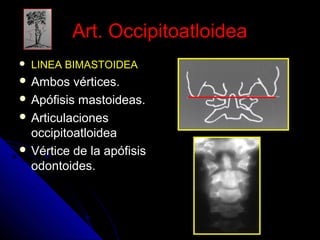 AArrtt.. OOcccciippiittooaattllooiiddeeaa 
 LLIINNEEAA BBIIMMAASSTTOOIIDDEEAA 
 AAmmbbooss vvéérrttiicceess.. 
 AAppóóffiissiiss mmaassttooiiddeeaass.. 
 AArrttiiccuullaacciioonneess 
oocccciippiittooaattllooiiddeeaa 
 VVéérrttiiccee ddee llaa aappóóffiissiiss 
ooddoonnttooiiddeess.. 
 