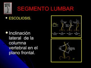 SSEEGGMMEENNTTOO LLUUMMBBAARR 
 EESSCCOOLLIIOOSSIISS.. 
IInncclliinnaacciióónn 
llaatteerraall ddee llaa 
ccoolluummnnaa 
vveerrtteebbrraall eenn eell 
ppllaannoo ffrroonnttaall.. 
 