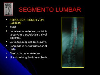 SSEEGGMMEENNTTOO LLUUMMBBAARR 
 FERGUSON-RISSER-VON 
LACKUM. 
 1948. 
 Localizar la vértebra que inicia 
la curvatura escoliotica a nivel 
proximal. 
 La vértebra apical de la curva. 
 Localizar vértebra transicional 
distal. 
 Centro de cada vértebra. 
 Nos da el ángulo de escoliosis. 
 