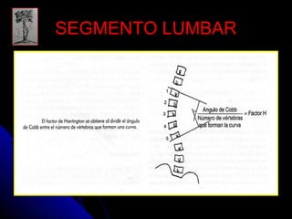 SSEEGGMMEENNTTOO LLUUMMBBAARR 
 