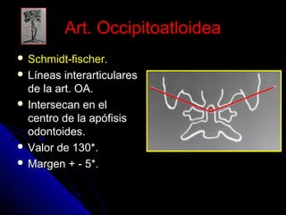 AArrtt.. OOcccciippiittooaattllooiiddeeaa 
 SScchhmmiiddtt--ffiisscchheerr.. 
 LLíínneeaass iinntteerraarrttiiccuullaarreess 
ddee llaa aarrtt.. OOAA.. 
 IInntteerrsseeccaann eenn eell 
cceennttrroo ddee llaa aappóóffiissiiss 
ooddoonnttooiiddeess.. 
 VVaalloorr ddee 113300**.. 
 MMaarrggeenn ++ -- 55**.. 
 