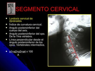 SSEEGGMMEENNTTOO CCEERRVVIICCAALL 
 LLoorrddoossiiss cceerrvviiccaall ddee 
IISSHHIIHHAARRAA 
 ÍÍnnddiiccee ddee ccuurrvvaattuurraa cceerrvviiccaall.. 
 AAnngguulloo ppoosstteerrooiinnffeerriioorr ddeell 
ccuueerrppoo ddeell aaxxiiss.. 
 AAnngguulloo ppoosstteerrooiinnffeerriioorr ddeell ccppoo.. 
DDee llaa 77mmaa vvéérrtteebbrraa.. 
 LLíínneeaa ppeerrppeennddiiccuullaarr ddeessddee eell 
áánngguulloo ppoosstteerrooiinnffeerriioorr ddee llooss 
ccppooss.. VVeerrtteebbrraalleess iinntteerrmmeeddiiooss.. 
 aa11++aa22++aa33++aa44 xx 110000 
A 
A 
a1 
a2 
a3 
a4 
 
