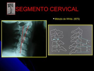 SSEEGGMMEENNTTOO CCEERRVVIICCAALL 
Método de White. (l975) 
 