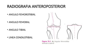 Tibia Linea MEDICIONES RADIOGRAFICAS DE LA RODILLA.pptx