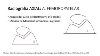 MEDICIONES RADIOGRAFICAS EN RODILLA 2.pptx