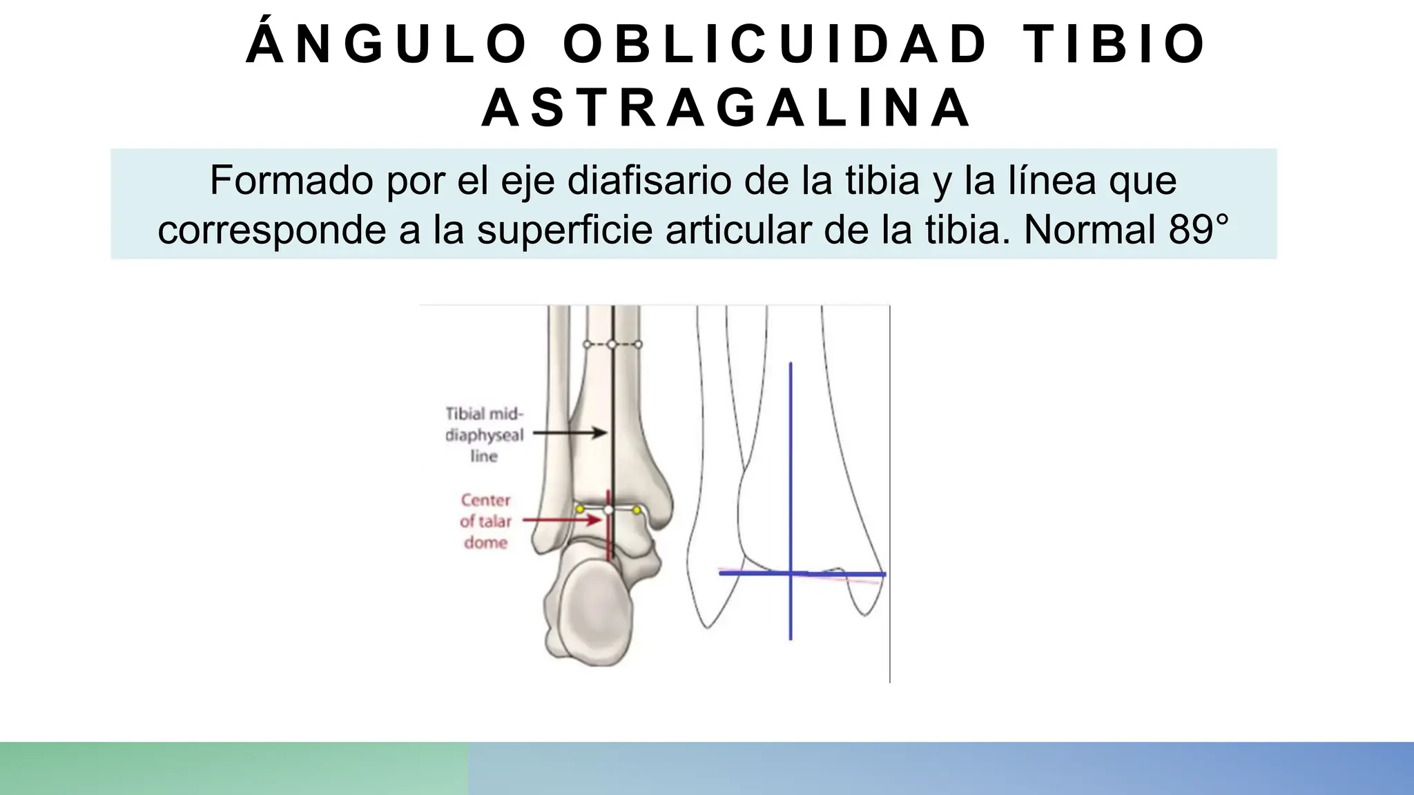 Angulo Tobillo Mediciones radiográficas de tobillo.pptx