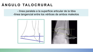 Angulo Tobillo Mediciones radiográficas de tobillo.pptx