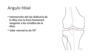 Tibia Linea Mediciones radiológicas de rodilla.pptx