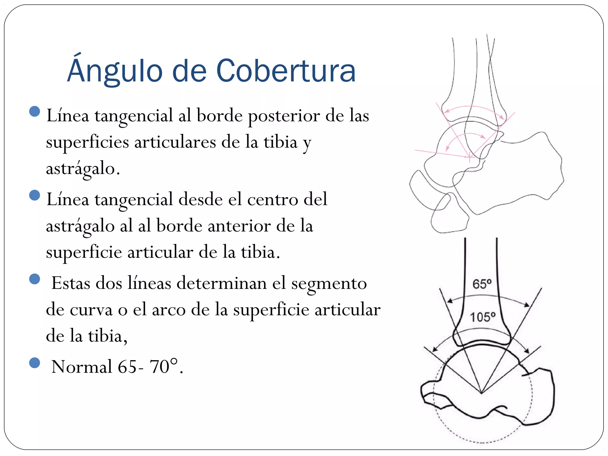 Angulo Tobillo Mediciones Radiográficas de Tobillo | PPT