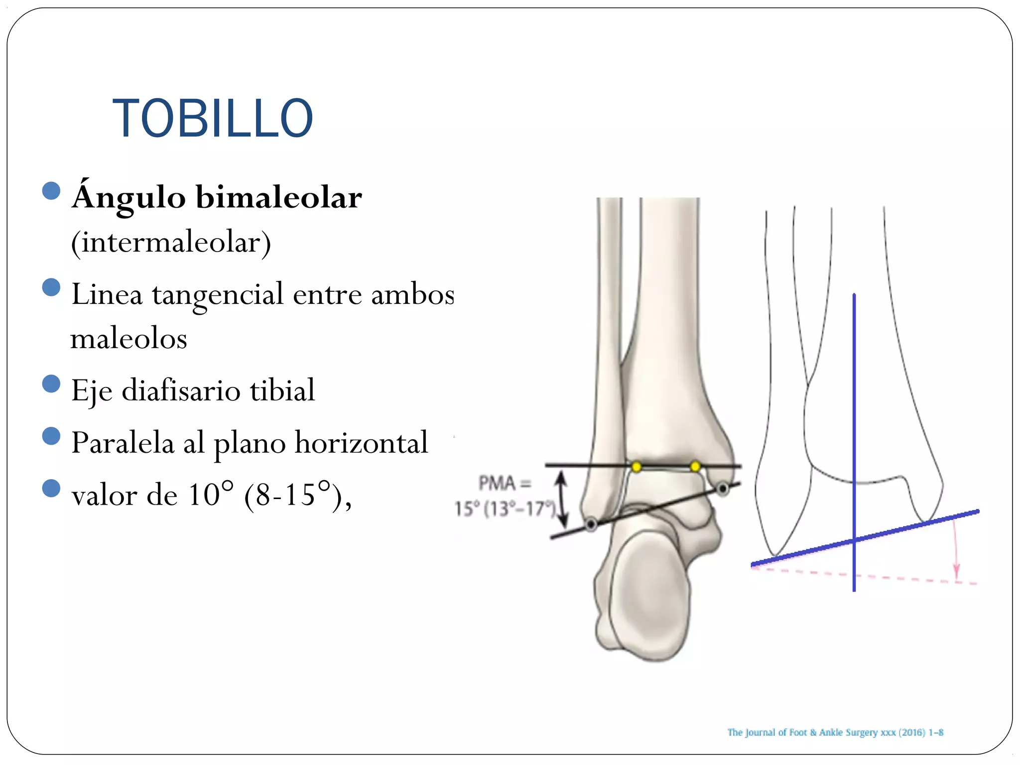 Angulo Tobillo Mediciones Radiográficas de Tobillo | PPT