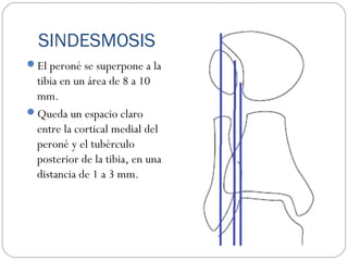 SINDESMOSIS
El peroné se superpone a la
tibia en un área de 8 a 10
mm.
Queda un espacio claro
entre la cortical medial del
peroné y el tubérculo
posterior de la tibia, en una
distancia de 1 a 3 mm.
 
