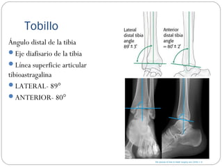 Tobillo
Ángulo distal de la tibia
Eje diafisario de la tibia
Línea superficie articular
tibioastragalina
LATERAL- 89°
ANTERIOR- 80°
 