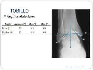 TOBILLO
Ángulos Maleolares
 