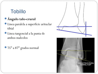 Tobillo
Ángulo talo-crural
Linea paralela a superficie arituclar
tibial
Linea tangencial a la punta de
ambos maleolos
75° a 87° grados normal
 