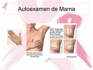 Autoexamen de Mama
 