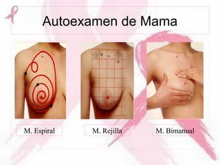Autoexamen de Mama
M. Espiral M. Rejilla M. Bimanual
 