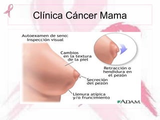 Clínica Cáncer Mama
 