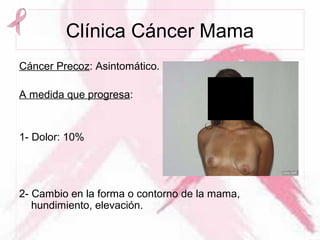 Clínica Cáncer Mama
Cáncer Precoz: Asintomático.
A medida que progresa:
1- Dolor: 10%
2- Cambio en la forma o contorno de la mama,
hundimiento, elevación.
 