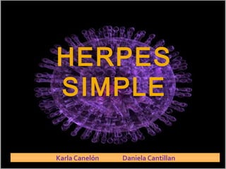 HERPES
SIMPLE
Karla Canelón Daniela Cantillan
 