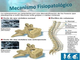 Mecanismo Fisiopatológico
 
