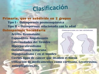 Clasificación
Primaria, que se subdivide en 2 grupos
Tipo I - Osteoporosis posmenopáusica
Tipo II – Osteoporosis relacionada con la edad
Osteoporosis Secundaria
       · Artritis Reumatoide
       · Espondilitis Anquilosante
       · Enfermedades del Tiroides
       · Hiperparatiroidismo
       · Ooforectomia temprana
       · Hipogonadismo ( en el hombre )
       · Ciertos tipos de cáncer que invaden el hueso
       · Utilización de medicamentos como cortisona, Levotiroxina,
antiepilépticos,etc.
 