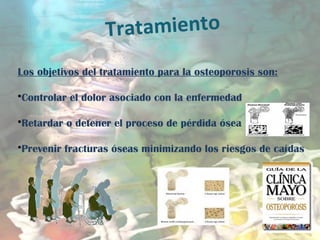 Tratamiento
Los objetivos del tratamiento para la osteoporosis son:
•Controlar el dolor asociado con la enfermedad
•Retardar o detener el proceso de pérdida ósea
•Prevenir fracturas óseas minimizando los riesgos de caídas
 