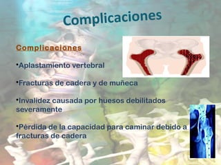 Complicaciones
Complicaciones
   
•Aplastamiento vertebral
•Fracturas de cadera y de muñeca
•Invalidez causada por huesos debilitados
severamente
•Pérdida de la capacidad para caminar debido a
fracturas de cadera
 