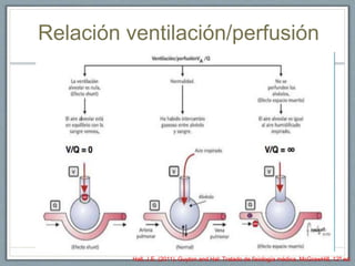 Relación ventilación/perfusión
Hall, J.E. (2011). Guyton and Hal: Tratado de fisiología médica. McGrawHill, 12ª ed.
 