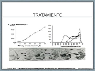 TRATAMIENTO
• SOPORTE VENTILATORIO
• MODO
• VMC-PCV
• Vc: 6 ml/kg PBW (Inicio 8 ml/kg PWB) <Q2H hasta alcanzar
objetivo.
• Frecuencia: f x VT
• Ajustar a una meta de Ph 7.30-7.45
• FIO2/Peep
• I:E: 1:3 o 1:1
• Pa02: 55-80 torr / Sp02: 88-95%
Walkey, Allan J. “Acute respiratory distress syndrome: epidemiology and management approaches”. Clinical Epidemiology 2012:
 