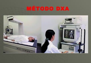 MÉTODO DXA 