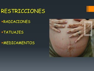 RESTRICCIONES
RADIACIONES
TATUAJES
MEDICAMENTOS
 