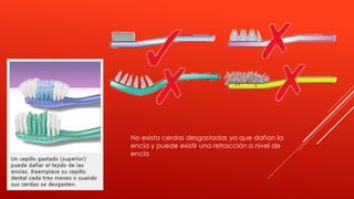 No exista cerdas desgastadas ya que dañan la
encía y puede existir una retracción a nivel de
encía
 