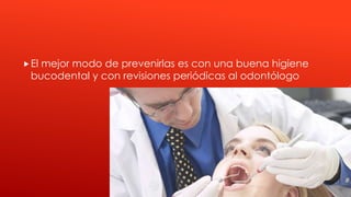 El mejor modo de prevenirlas es con una buena higiene
bucodental y con revisiones periódicas al odontólogo
 
