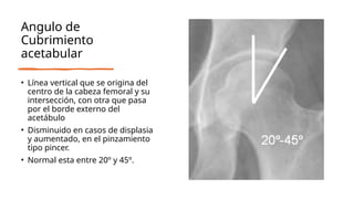 Medidas Radiologicas Cadera.pptx
